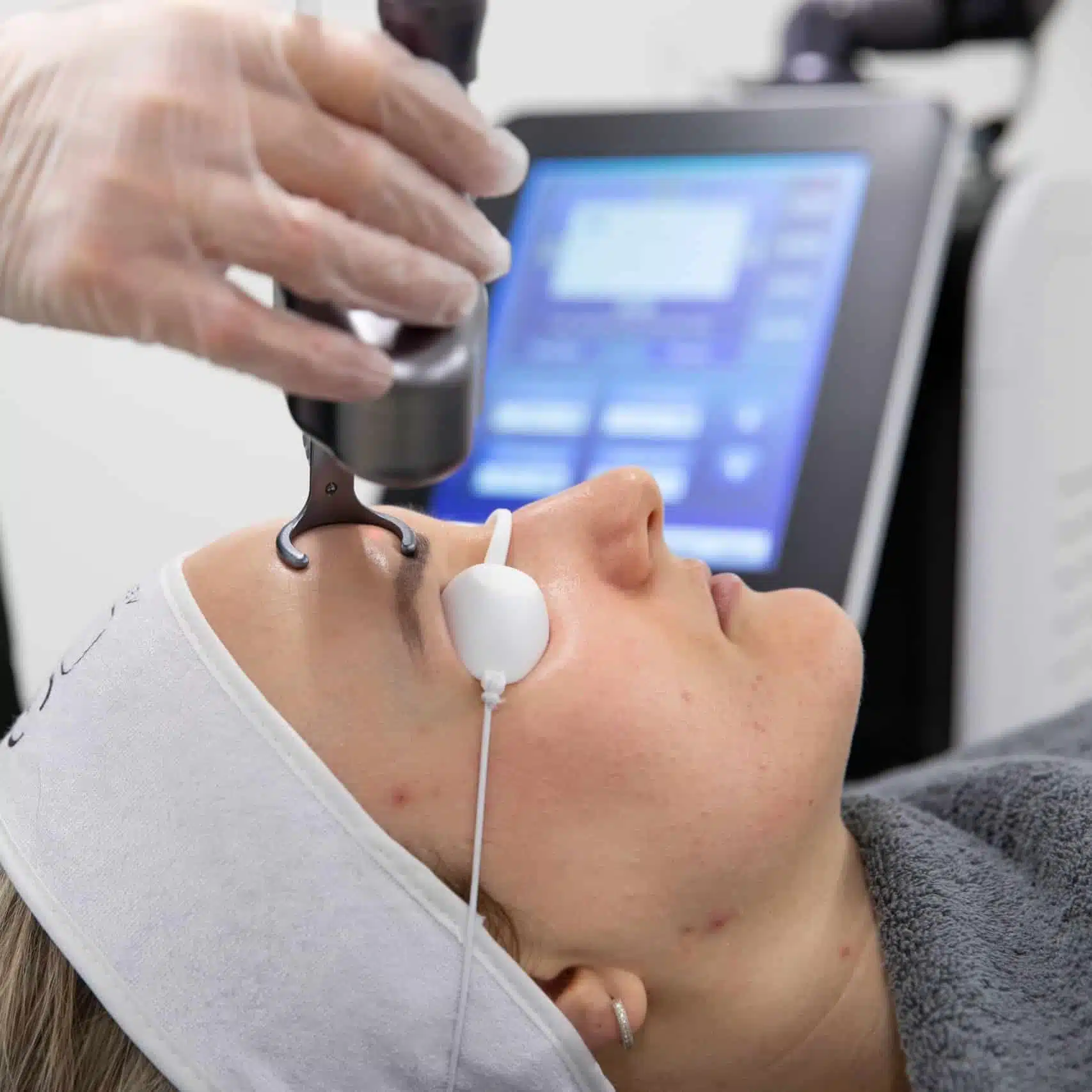 Skin Rejuvenation | SR Derma Laser Clinic